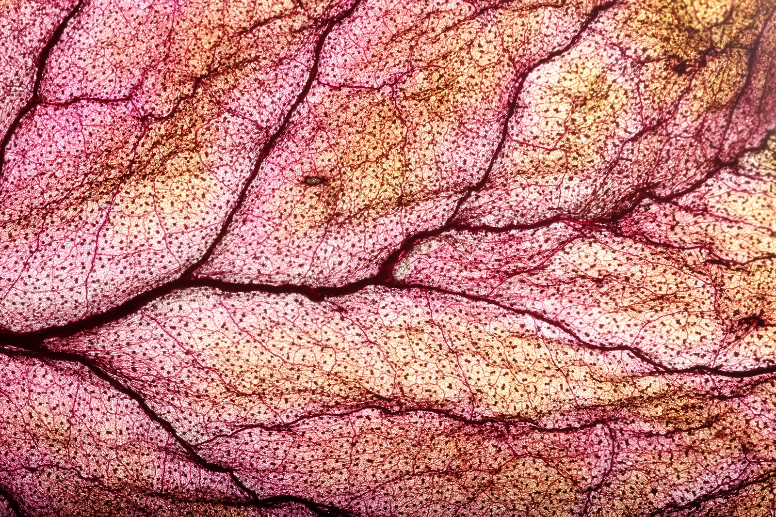 Close-up macro shot of an abstract pink and brown textured pattern showing intricate vein-like structures. The beginning of the study of multidisciplinary hair loss treatment.
